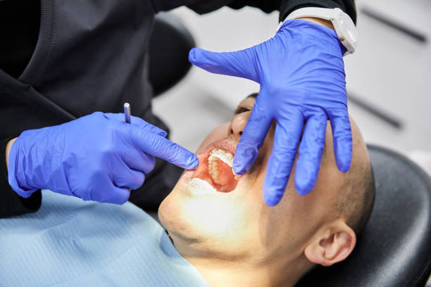 Best Emergency Wisdom Teeth Removal in Skidmore, TX